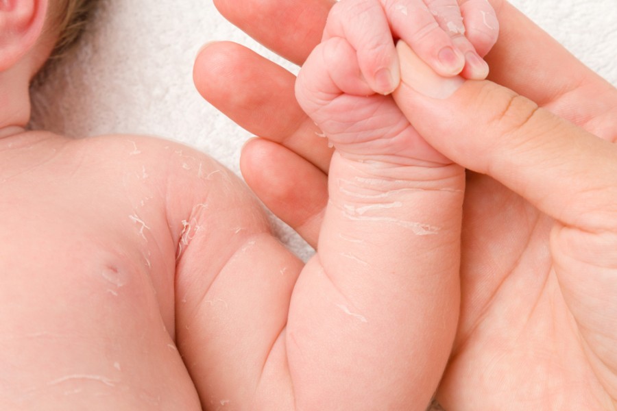 Crème peau sèche bébé : tous les soins hydratants pour la peau de bébé !