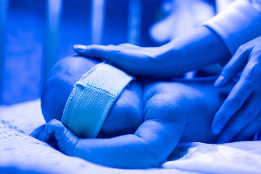 Jaunisse de bébé : comment la soigner ?