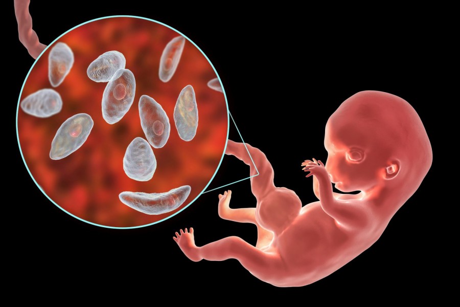 Comprendre la toxoplasmose en étant enceinte